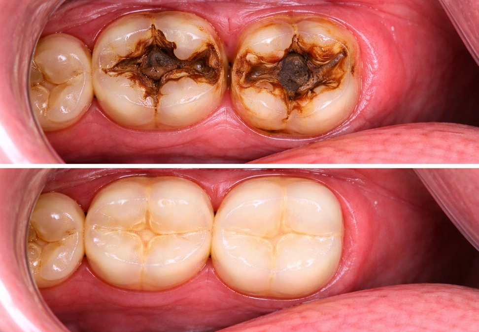 Before treatment