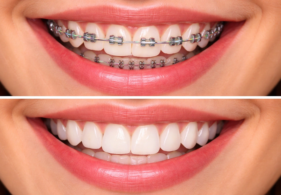 Before treatment