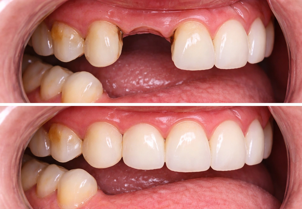 Before treatment